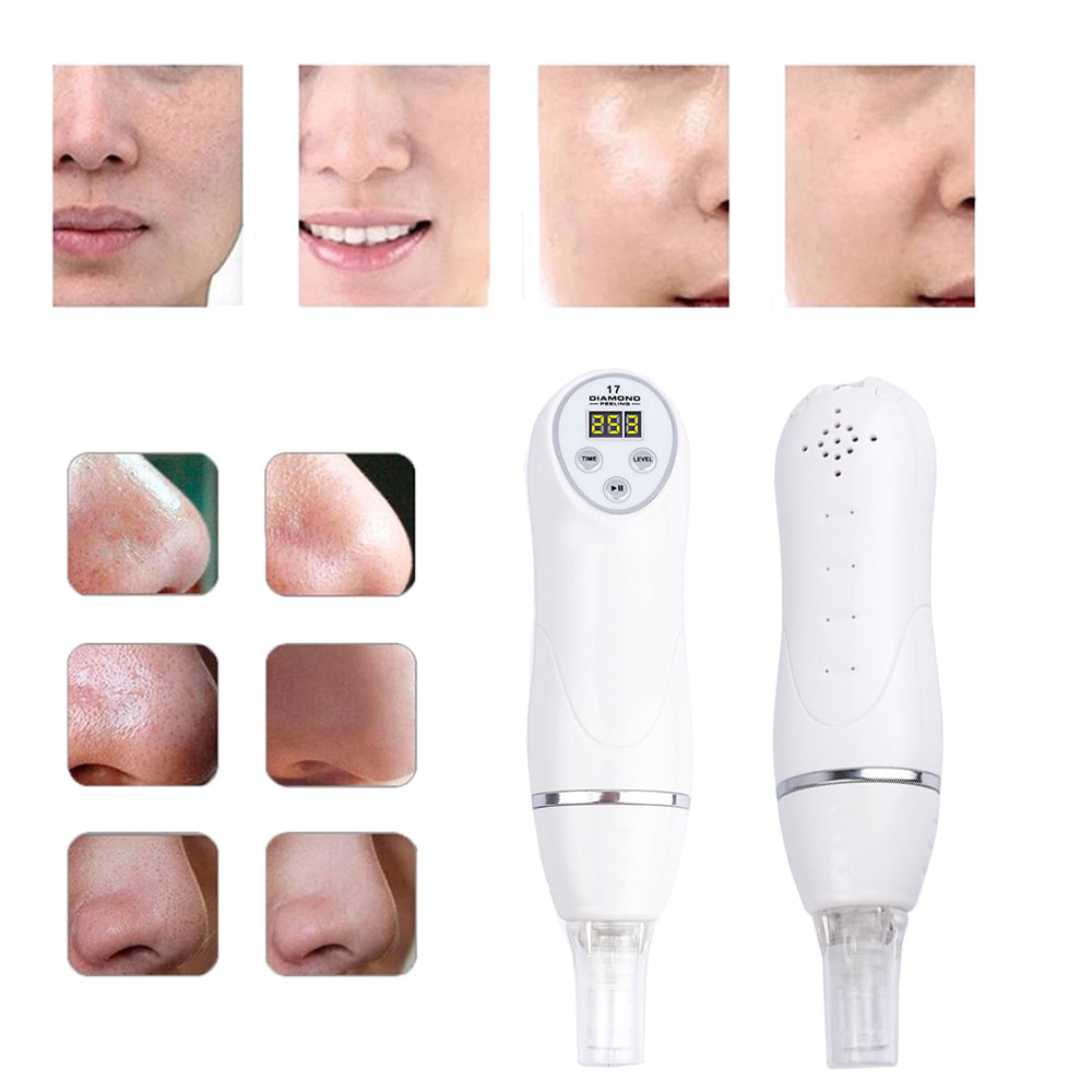 Portable Digital Microdermabrasion Diamond Dermabrasion Pen Vacuum Massage Skin Peeling Beauty Equipment