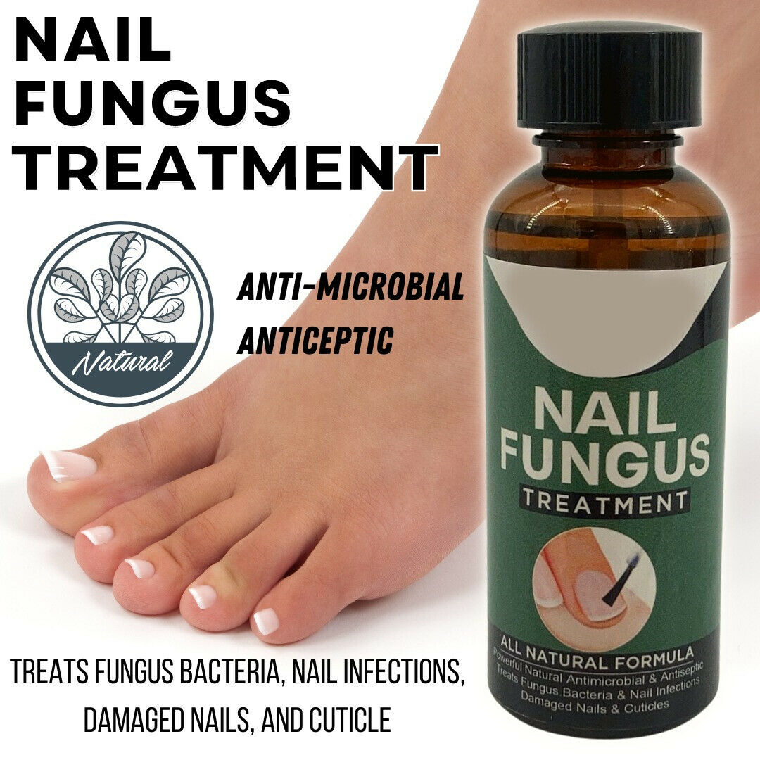 Anti Fungal Nail Treatment Nail Finger Toe Fungus Onychomycosis Remover