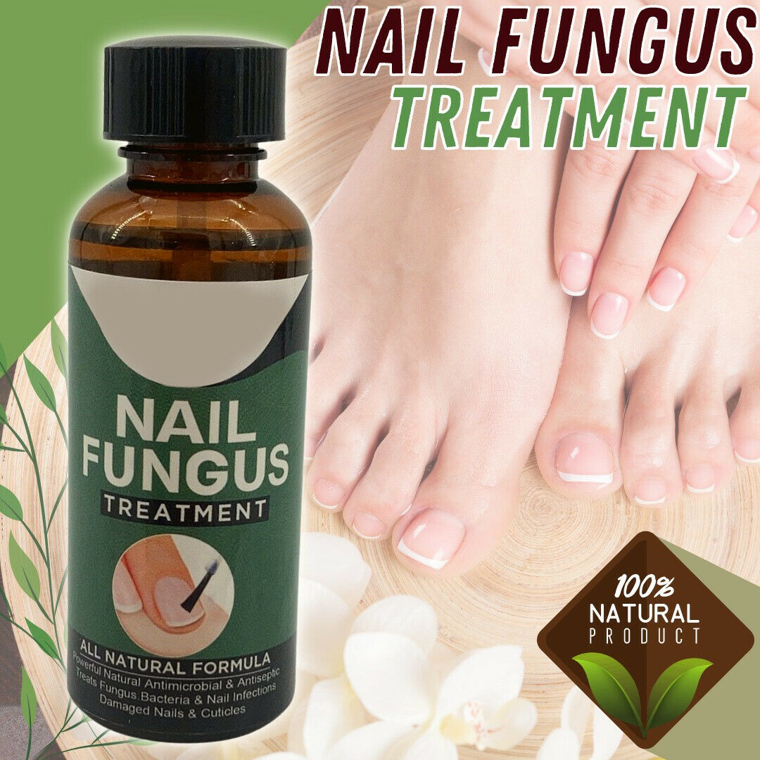 Anti Fungal Nail Treatment Nail Finger Toe Fungus Onychomycosis Remover