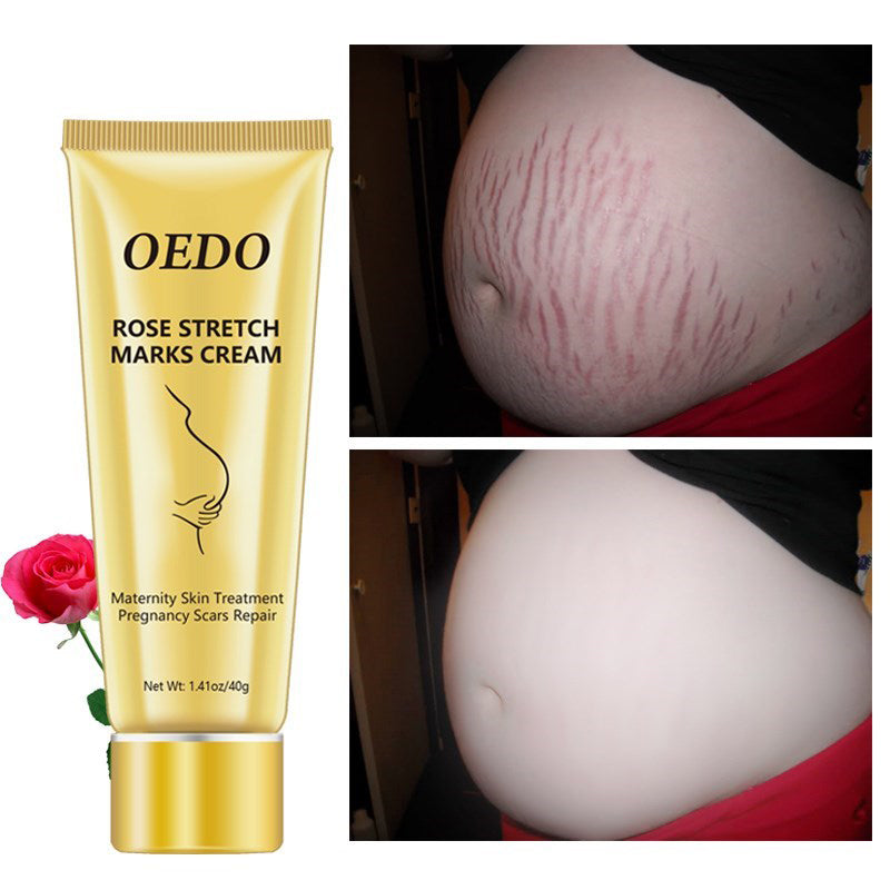 Rose Stretch Mark Removal Cream Anti-Aging