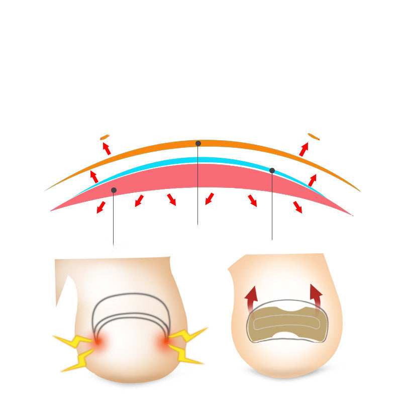 Glue-free orthopaedic nail fixation device