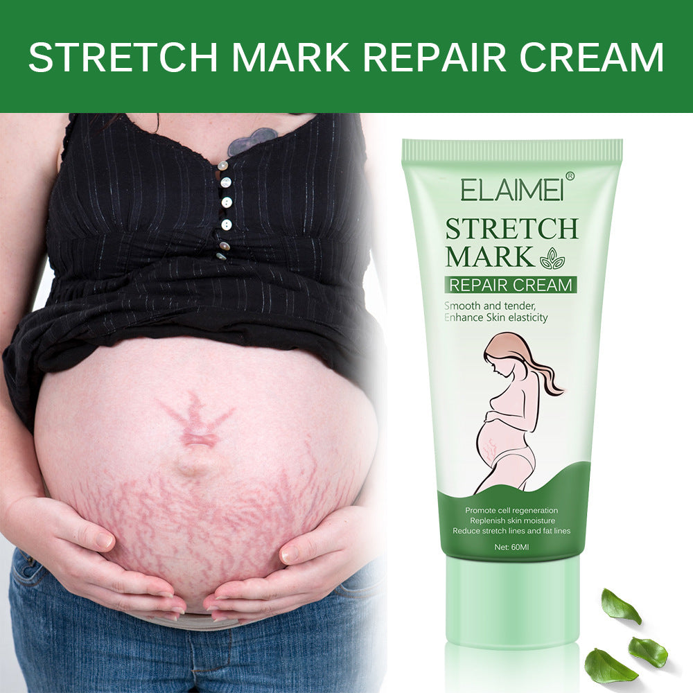 Stretch Mark Repair Cream Smooth Tender Enhance Skin Elastictiy Acne Repair 60ml Anti-Aging Cream Pregnancy Scars