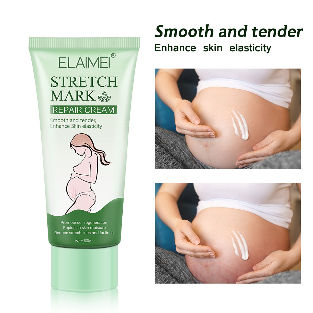 Stretch Mark Repair Cream Smooth Tender Enhance Skin Elastictiy Acne Repair 60ml Anti-Aging Cream Pregnancy Scars