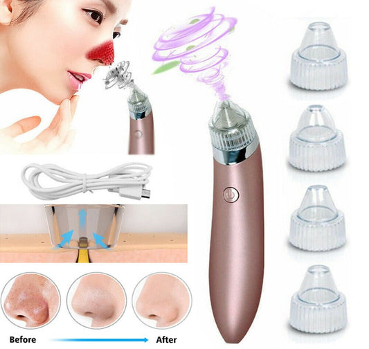 Electric Blackhead Vacuum Pore Cleaner Acne Pimple Remover Strong Suction Tool Electric Blackhead Remover Pore Vacuum Suction Diamond Dermabrasion Face Cleaner